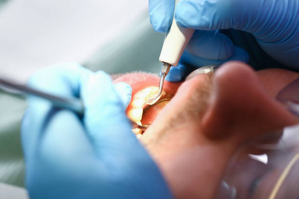 Best Tooth Infection Emergency Dentist  in Crocker, WA